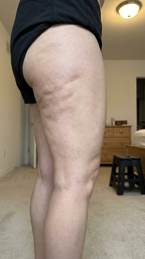 Day 1